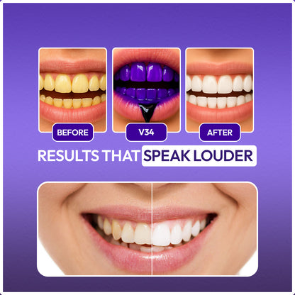 Hismile V34 Colour Corrector Teeth Brightening Serum (Original) | 30ml