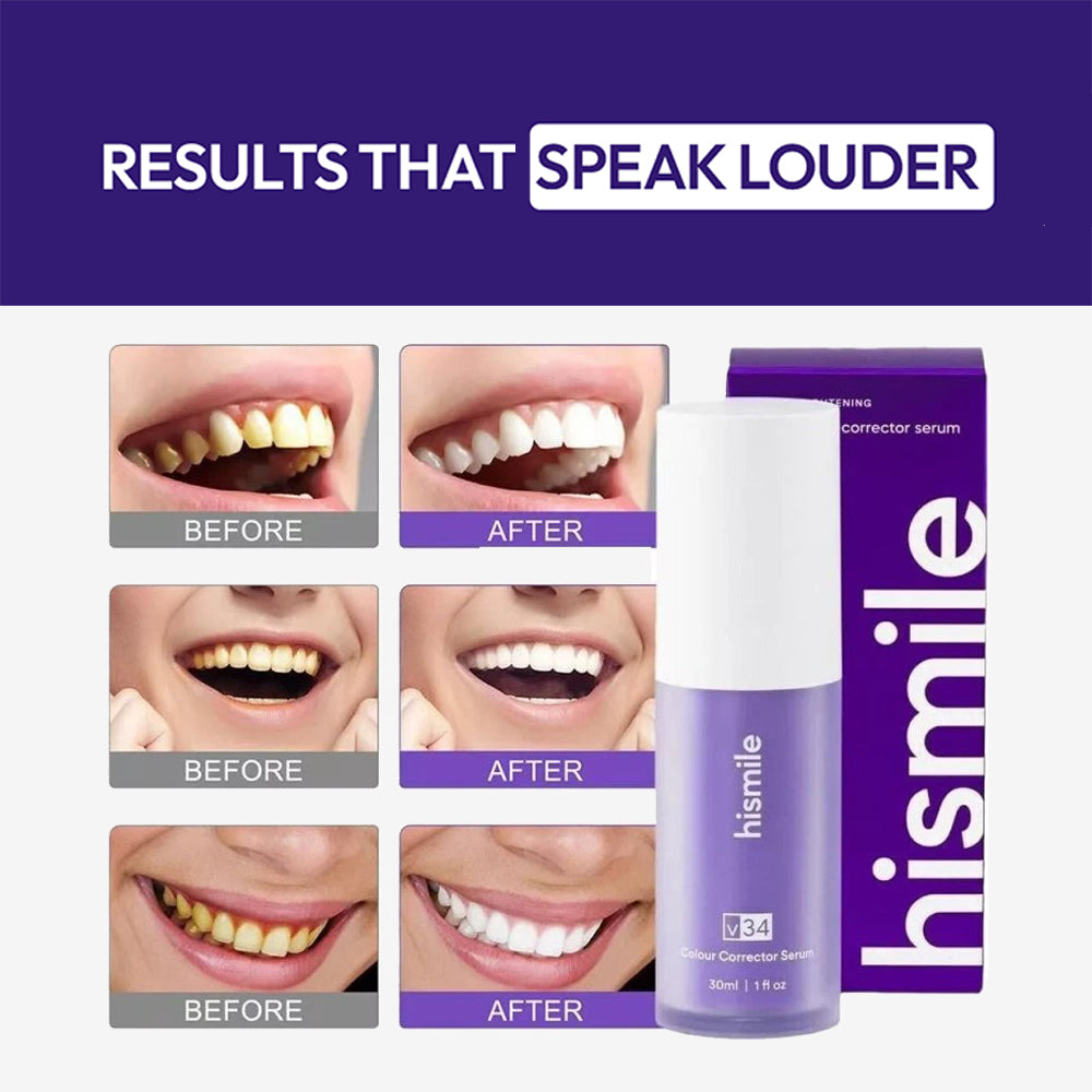 Hismile V34 Colour Corrector Teeth Brightening Serum (Original) | 30ml